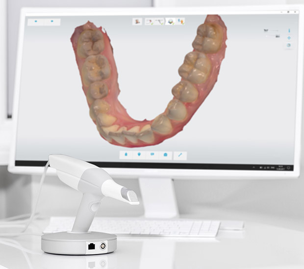 Clearwater 3D Cone Beam and 3D Dental Scans