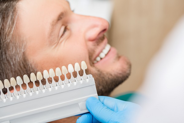 How Teeth Are Prepared For Dental Veneers