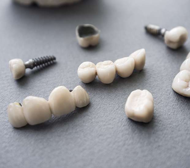 Clearwater The Difference Between Dental Implants and Mini Dental Implants